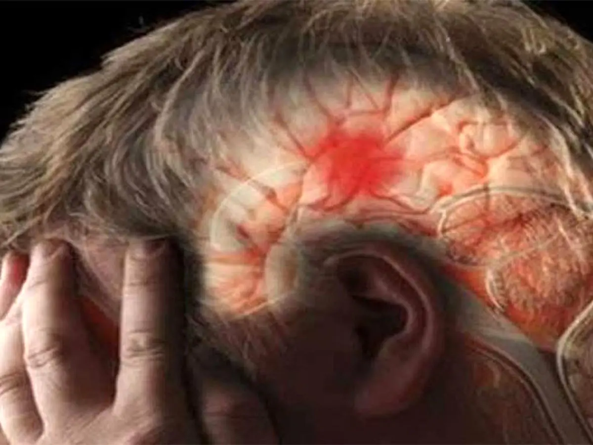 سکته مغزی در کمین افراد کم‌تحرک | بدن به چند ساعت فعالیت در هفته نیاز دارد؟