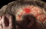 سکته مغزی در کمین افراد کم‌تحرک | بدن به چند ساعت فعالیت در هفته نیاز دارد؟