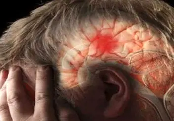 سکته مغزی در کمین افراد کم‌تحرک | بدن به چند ساعت فعالیت در هفته نیاز دارد؟