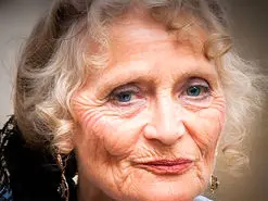 علت عدم تقارن صورت چیست؟