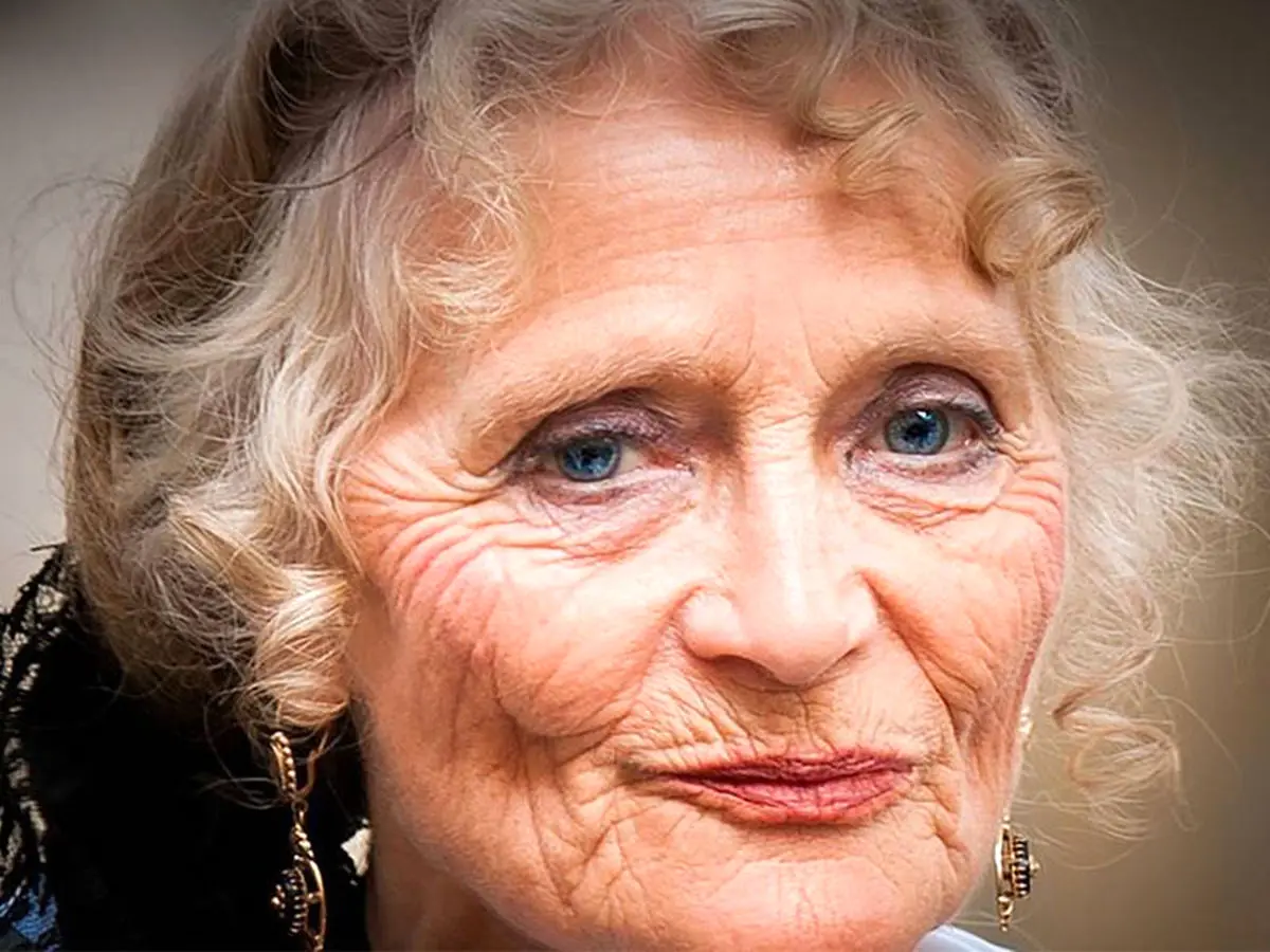 علت عدم تقارن صورت چیست؟