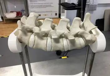 هوشمند شدن درمان ستون فقرات در ایران با سامانه جراحی رباتیک