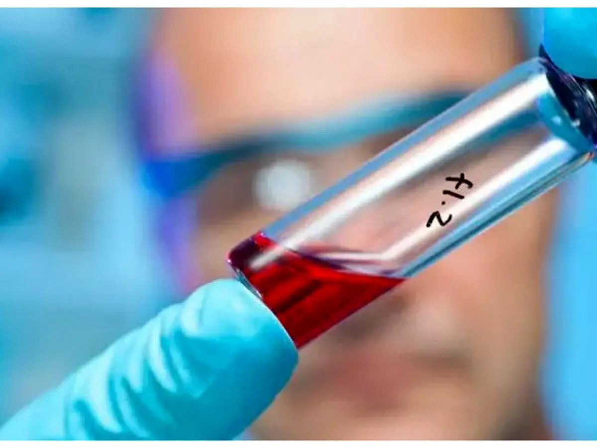 سلول درمانی کووید ۱۹ با نتایج الهام بخش