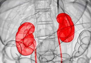 ساخت کلیه مصنوعی ؛ جایگزین دیالیز و پیوند کلیه