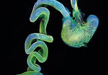 حقایقی درباره دومین مغز بدن که تاکنون از آن بی‌اطلاع بوده‌ایم