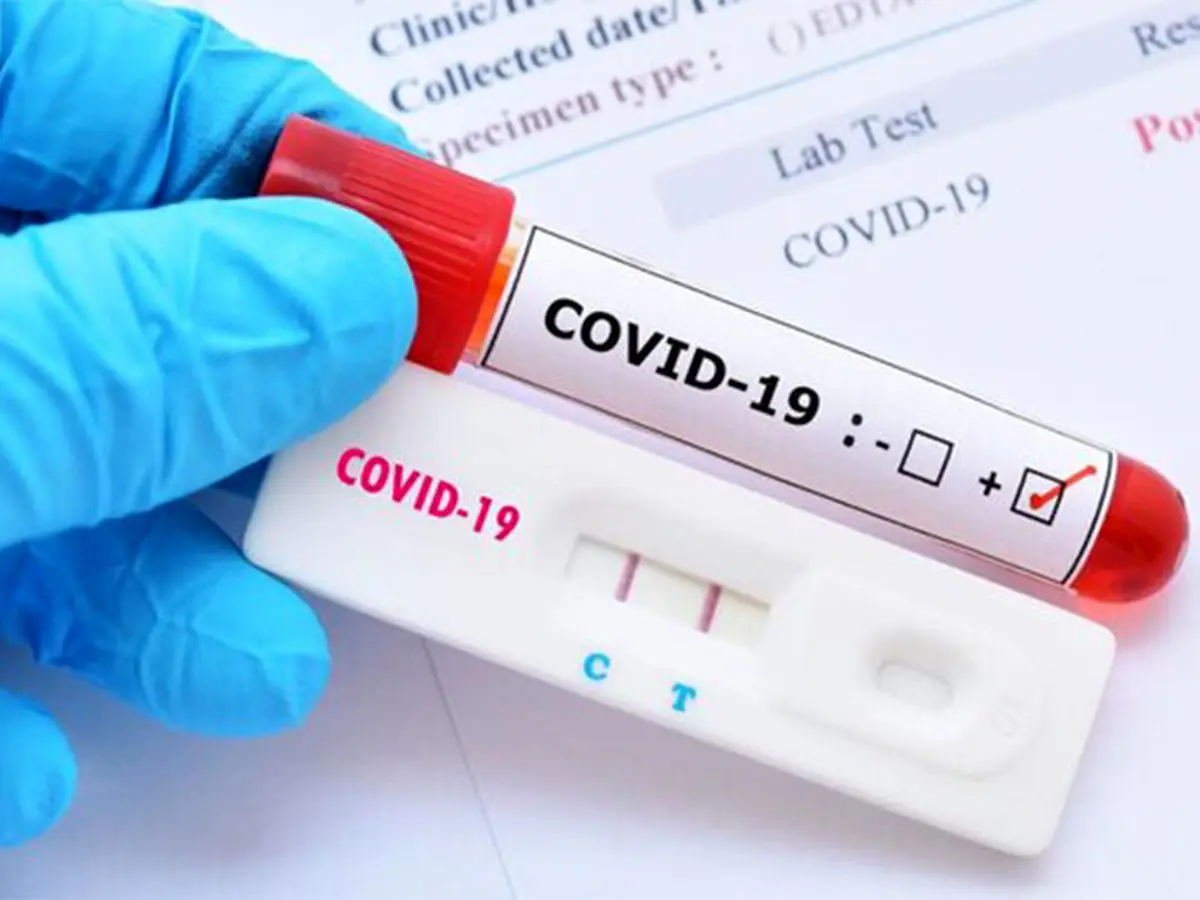 آیا تست آنتی بادی بعد از واکسن کرونا لازم است؟