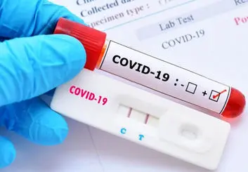 آیا تست آنتی بادی بعد از واکسن کرونا لازم است؟