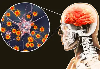 بازگشت آسیب مغزی ناشی از کرونا