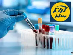 آزمایشگاه های طرف قرارداد با بیمه کوثر در تهران + شماره و آدرس