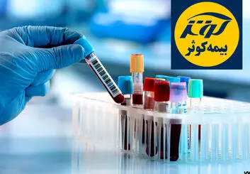 آزمایشگاه های طرف قرارداد با بیمه کوثر در تهران + شماره و آدرس