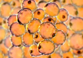 کشف آنزیمی که می‌تواند درمان چاقی باشد