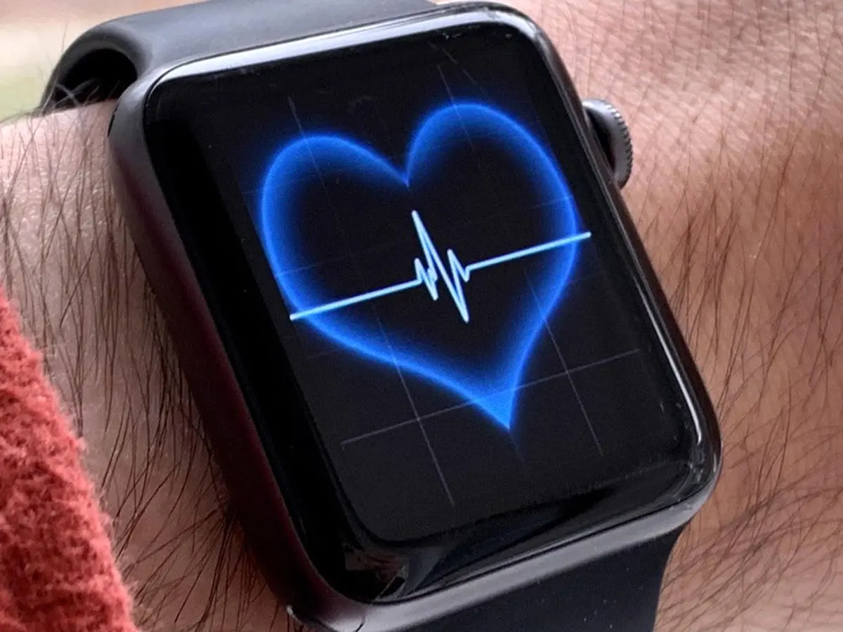 تشخیص بیماری تیروئید به وسیله ساعت اپل واچ