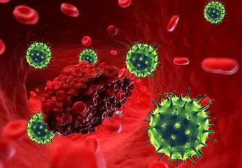 لختگی خون در بیماران کرونایی به سبب وجود آنتی‌بادی‌های سرکش