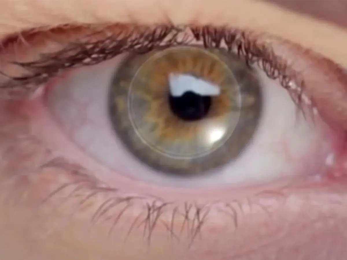 دستاورد بزرگ محققان ایرانی در ساخت قرنیه مصنوعی