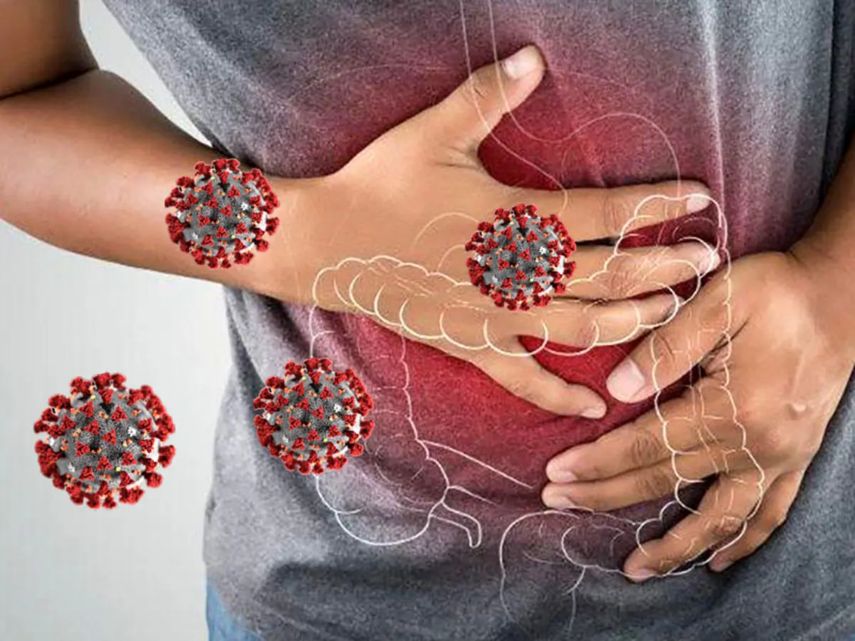 اختلال در عملکرد روده بر اثر کرونای شدید