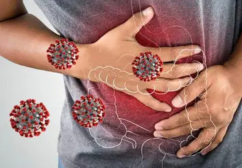 اختلال در عملکرد روده بر اثر کرونای شدید