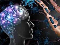 نوید درمان بیماری ام اس با کمک سلول‌های بنیادی