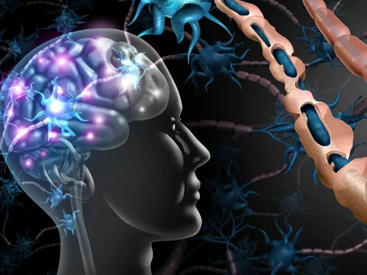 نوید درمان بیماری ام اس با کمک سلول‌های بنیادی