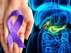 درمان سرطان پانکراس با استفاده از مولکول جدید MMRi62