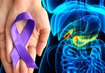 درمان سرطان پانکراس با استفاده از مولکول جدید MMRi62