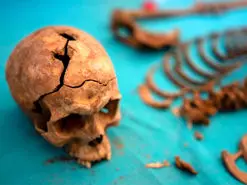 کشف اولین جراحی گوش در جمجمه‌ 5300 ساله