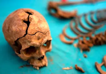 کشف اولین جراحی گوش در جمجمه‌ 5300 ساله