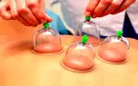 فصل بهار، بهترین زمان حجامت + فواید حجامت در ابتدای سال