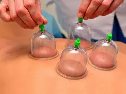 فصل بهار، بهترین زمان حجامت + فواید حجامت در ابتدای سال