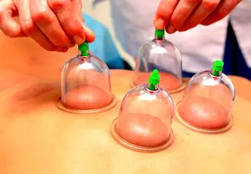 فصل بهار، بهترین زمان حجامت + فواید حجامت در ابتدای سال