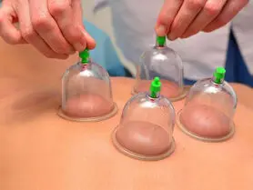 فصل بهار، بهترین زمان حجامت + فواید حجامت در ابتدای سال