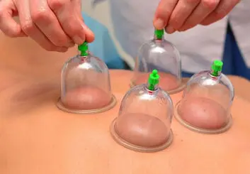 فصل بهار، بهترین زمان حجامت + فواید حجامت در ابتدای سال