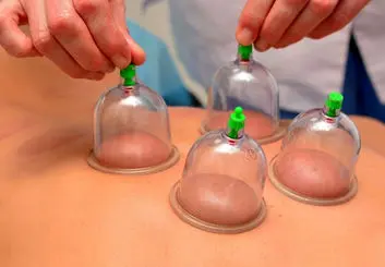 فصل بهار، بهترین زمان حجامت + فواید حجامت در ابتدای سال