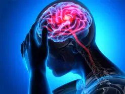 نقش تری گلیسیرید بالا در افزایش خطر سکته مغزی دوم