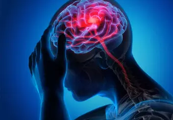 نقش تری گلیسیرید بالا در افزایش خطر سکته مغزی دوم