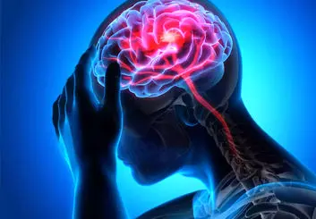 نقش تری گلیسیرید بالا در افزایش خطر سکته مغزی دوم