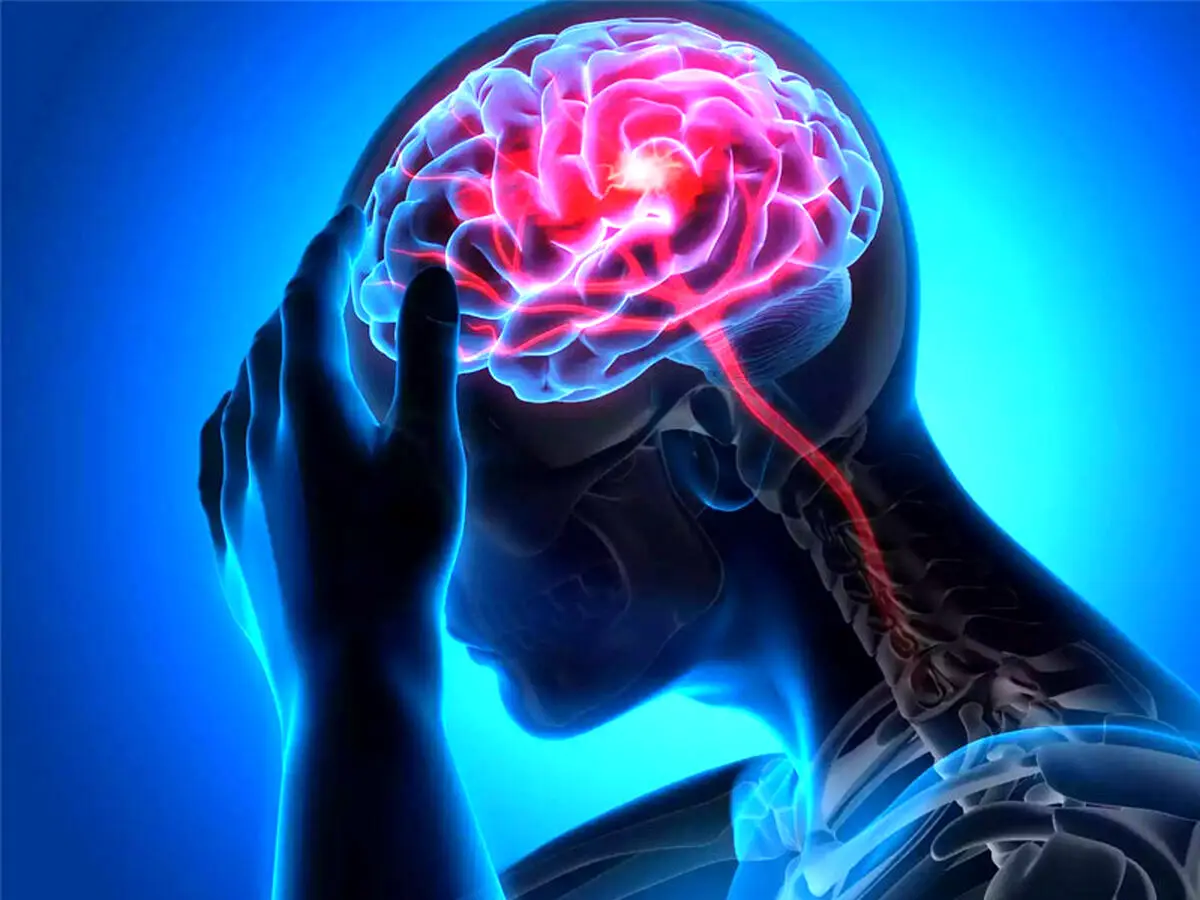 نقش تری گلیسیرید بالا در افزایش خطر سکته مغزی دوم