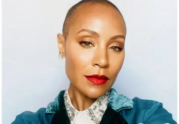 بیماری آلوپسی که همسر ویل اسمیت را دچار کرده چیست؟