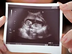 مدیرکل جمعیت وزارت بهداشت: غربالگری جنین ممنوع نشده است