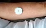 ساخت دستگاه تست قند خون بدون درد برای دیابتی ها