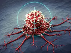 بهره‌گیری از امواج فراصوت در مقابله با سرطان و اثرگذاری 75 درصدی