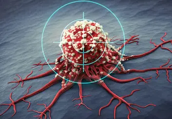بهره‌گیری از امواج فراصوت در مقابله با سرطان و اثرگذاری 75 درصدی