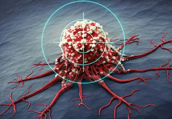 بهره‌گیری از امواج فراصوت در مقابله با سرطان و اثرگذاری 75 درصدی