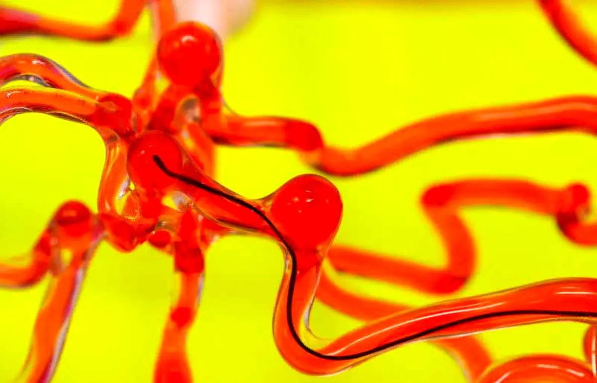 درمان سکته مغزی توسط ربات کرمی