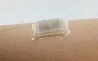 سونوگرافی از طریق یک چسب روی پوست!