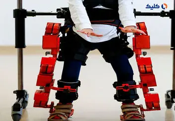 کودک مبتلا به فلج مغزی توانست نخستین گام‌های خود را با کمک یک اسکلت رباتیک بردارد