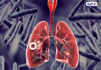 یکی از کشنده‌ترین بیماری‌های جهان بار دیگر در حال افزایش است