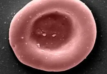 نخستین انتقال خون با سلول‌های پرورش‌یافته در آزمایشگاه انجام شد