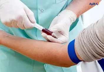 شناسایی بیماری آلزایمر قبل از بروز علائم با آزمایش خون!