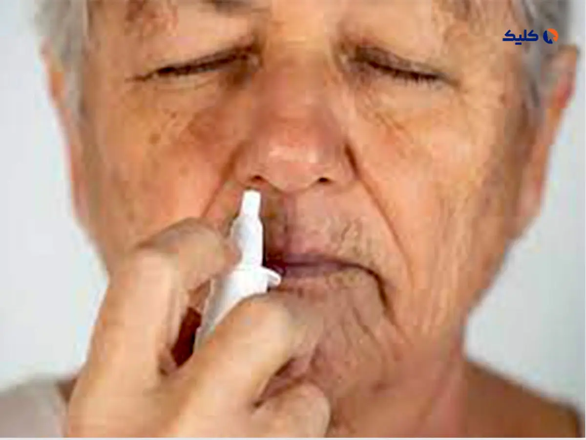 ترمیم آسیب‌های سکته مغزی در مغز با کمک اسپری کردن دارو در بینی