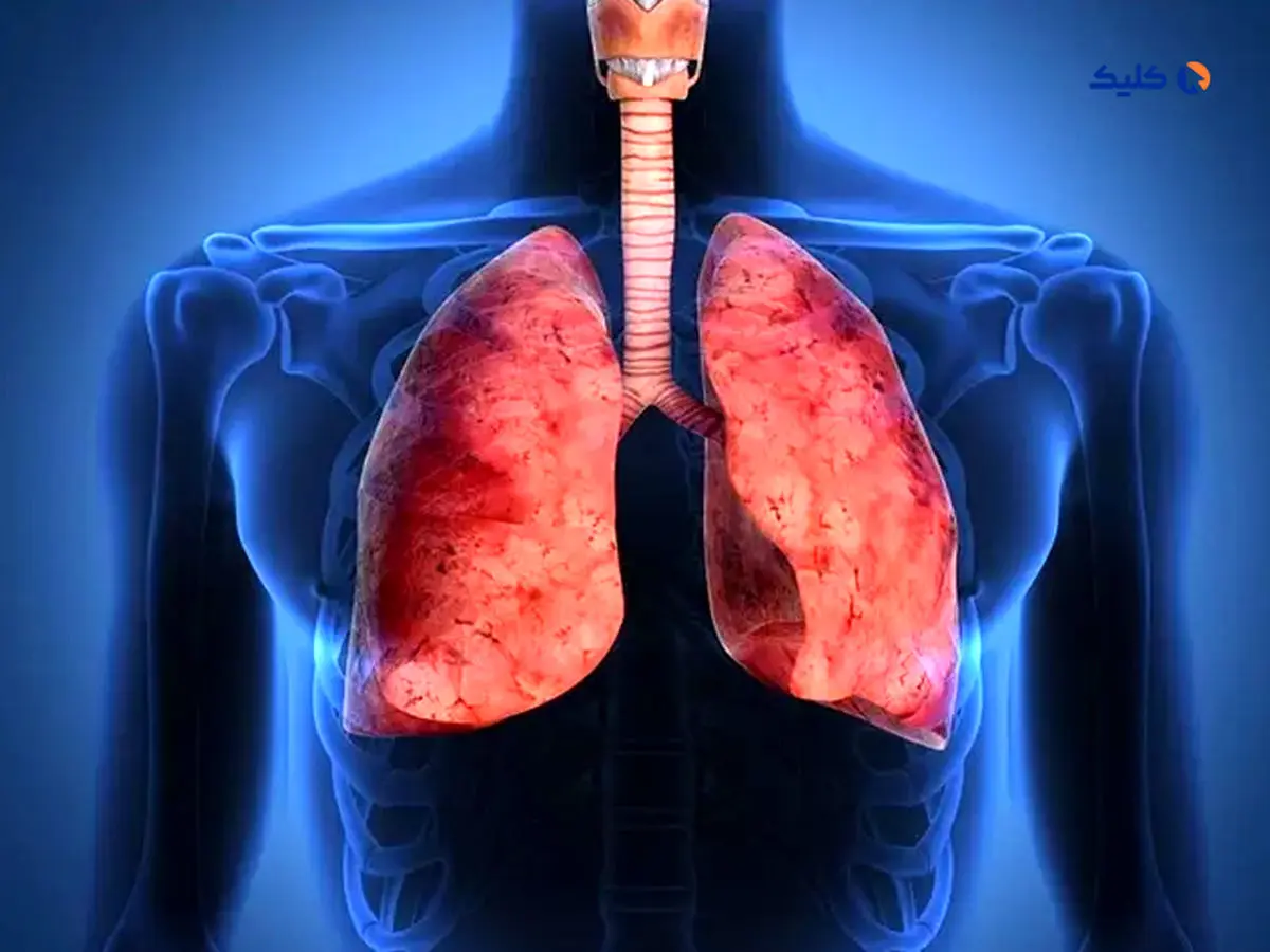 محافظت در برابر آسم آلرژیک